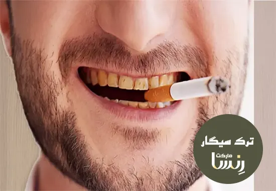 8 تا از علائم کمبود نیکوتین در بدن مجموعه ترک سیگار رنسا